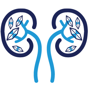 Nephrocalcinosis Icon